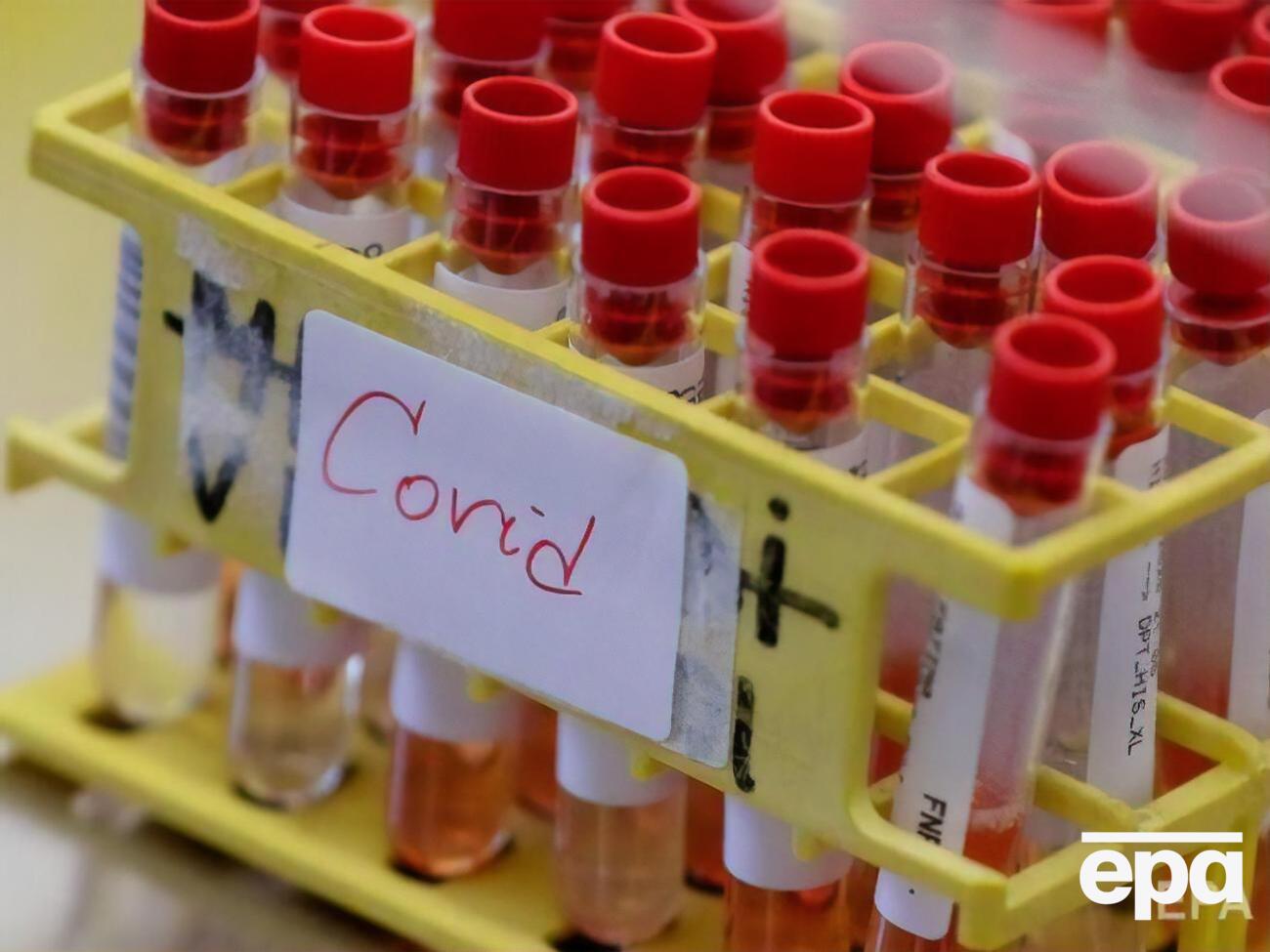 В Украине рекорд по числу выздоровевших от COVID-19 за сутки