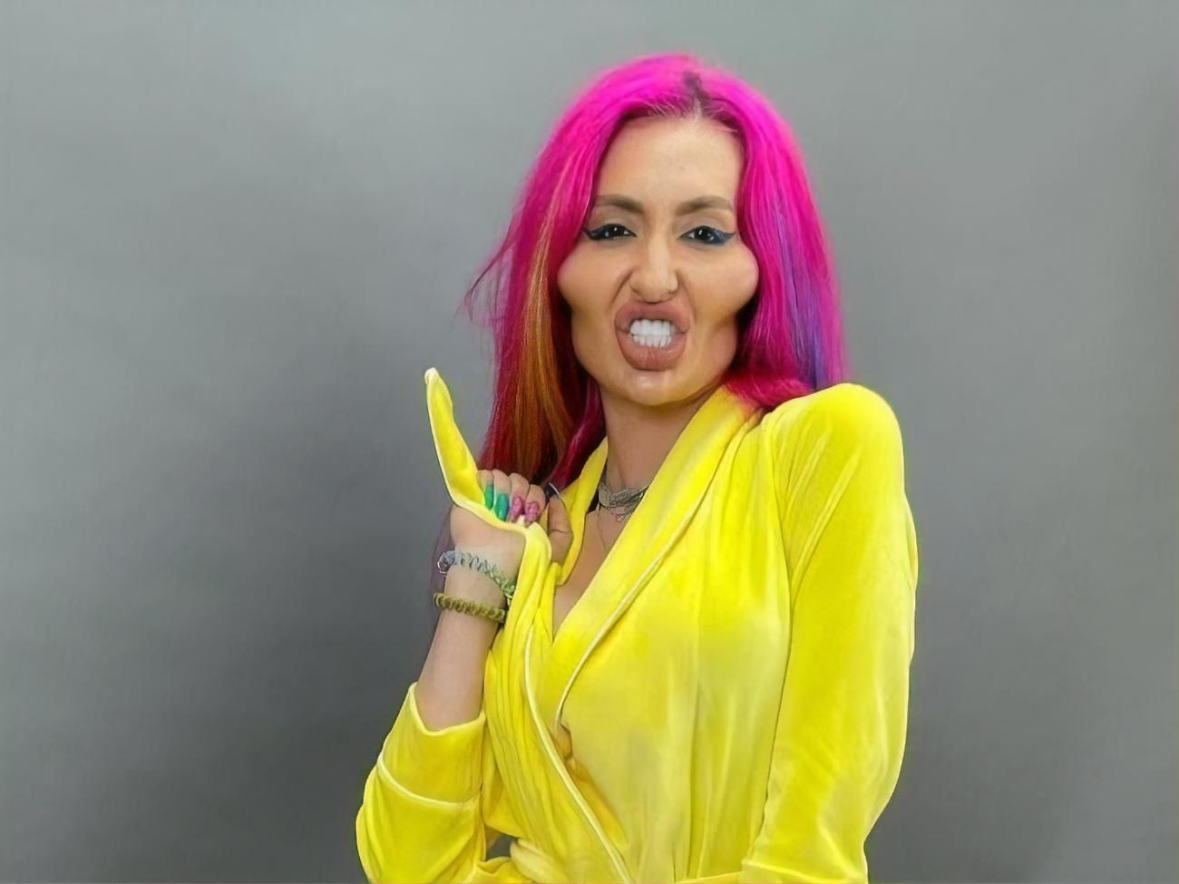 Всемирную известность Покрещук получила после того, как увеличила скулы