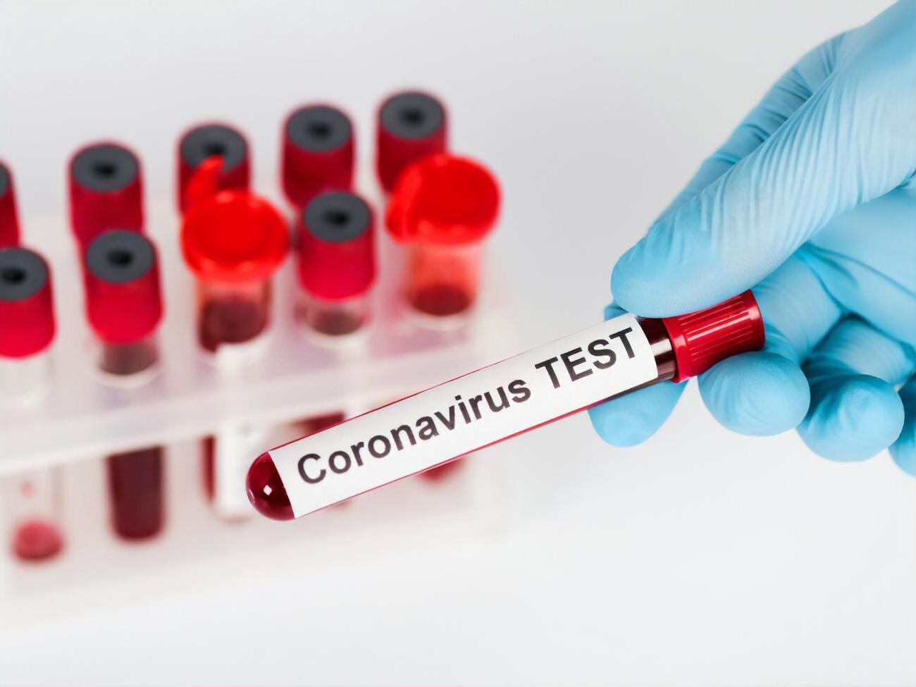 От COVID-19 в России умерло 48,5 тыс. человек