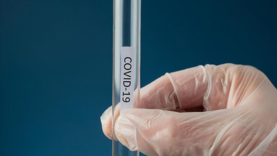 Упродовж доби в Києві від коронавірусу померло 14 осіб