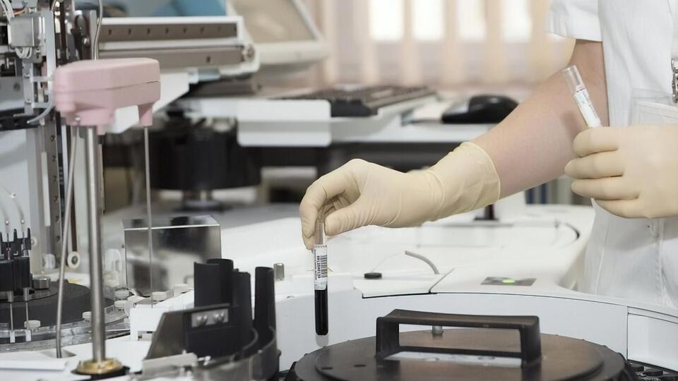 В Україні тести на COVID-19 робить 124 лабораторії всіх форм власності