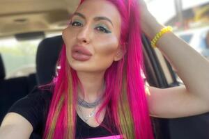 На увеличение скул Покрещук потратила около 60 тыс. грн