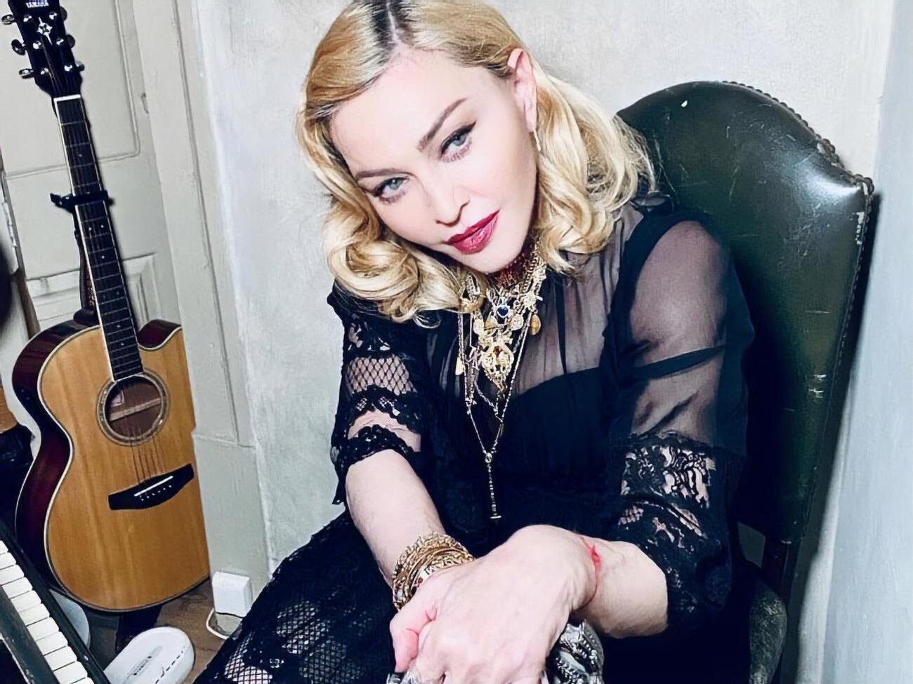 На своїй сторінці в Instagram Мадонна зізналася, що змушена використовувати тростину