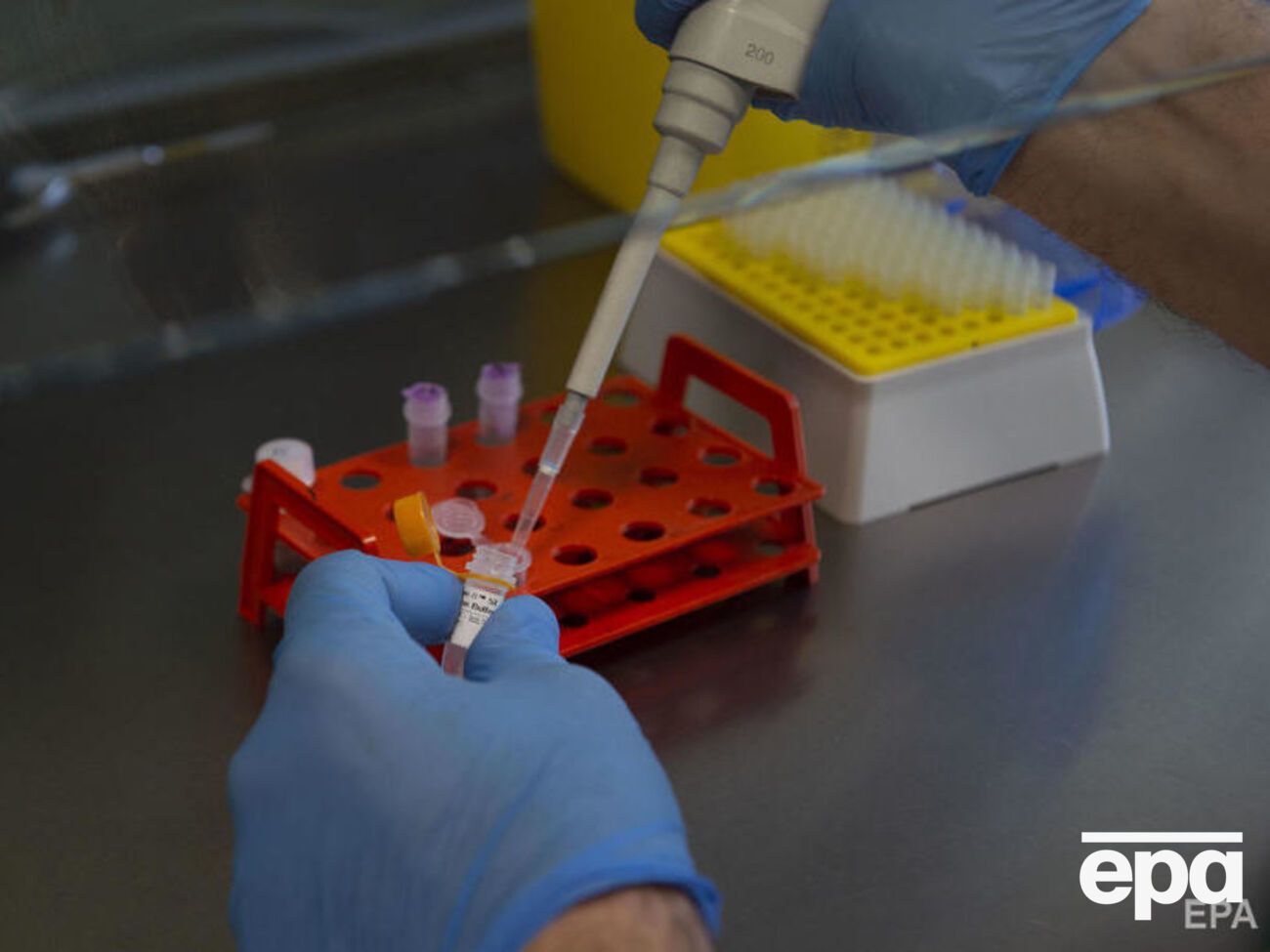 Проби перевірять на грип, а потім, імовірно, і на коронавірус