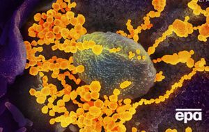 Атаку коронавируса SARS-CoV-2 на клетки человека сняли с помощью микроскопа