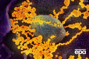 Атаку коронавируса SARS-CoV-2 на клетки человека сняли с помощью микроскопа