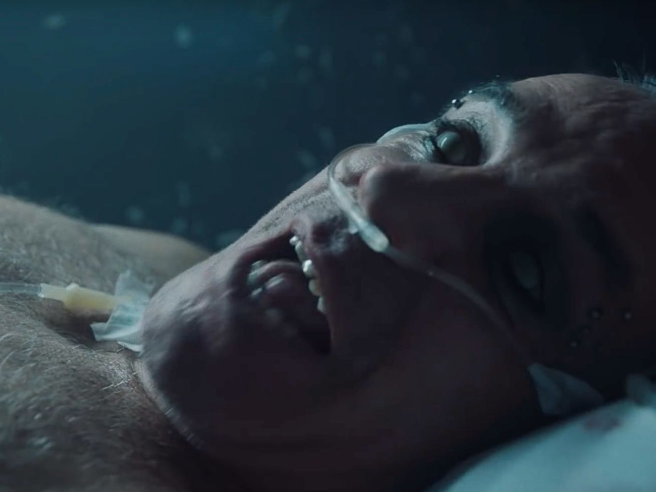 Линдеманн предстал лежащим на больничной койке