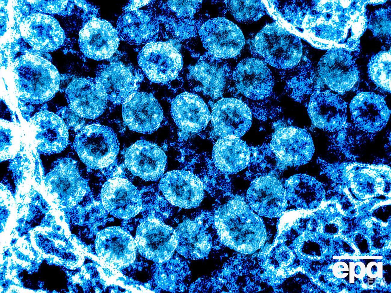 В Украине на данный момент нет подтвержденных случаев заражения коронавирусом