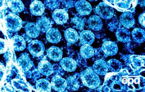 В Украине на данный момент нет подтвержденных случаев заражения коронавирусом