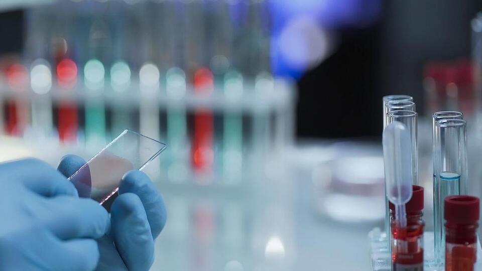 Результати аналізів жінки будуть відомі за кілька днів