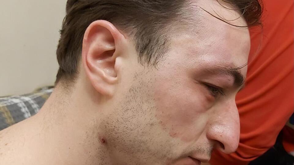 Безносенко переніс операції через погане самопочуття