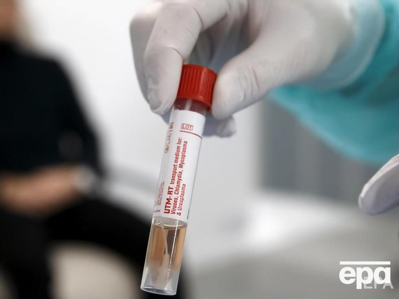 Загальна кількість заражених коронавірусом у світі перевищила 175 тис., понад 6,7 тис. осіб померло