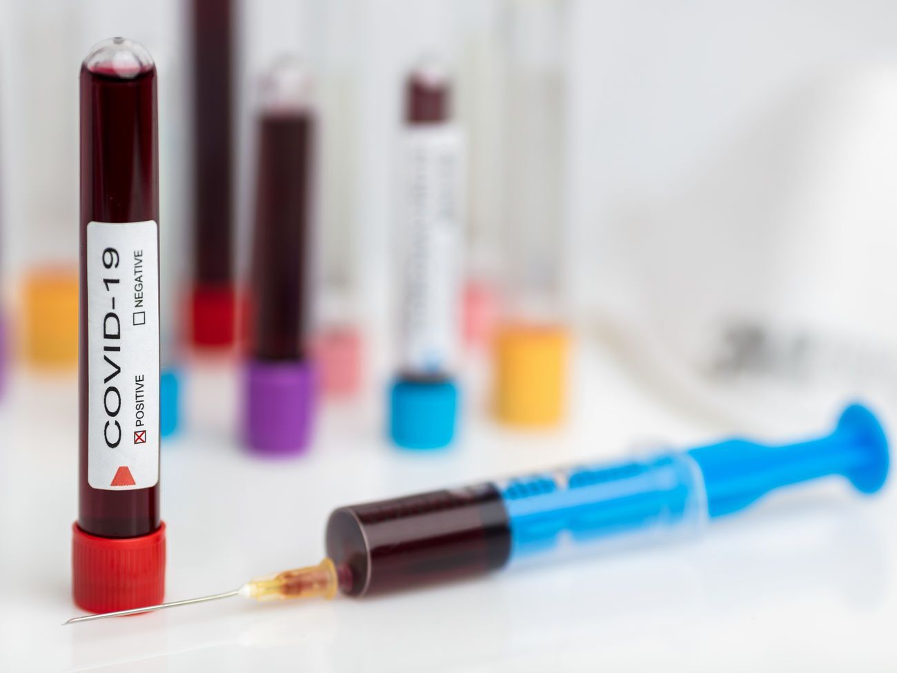 В&nbsp;Ивано-Франковской области зафиксировано пять случаев инфицирования