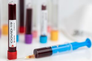 В Івано-Франківській області зафіксовано п'ять випадків інфікування