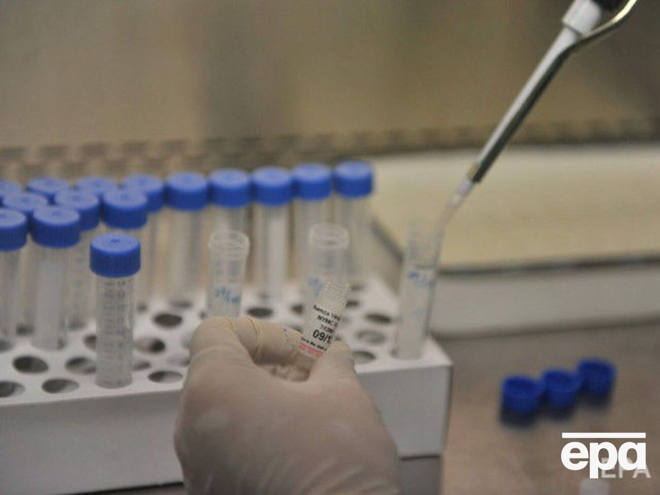 После получения вакцины участники эксперимента проведут 14 дней в карантине под медицинским наблюдением