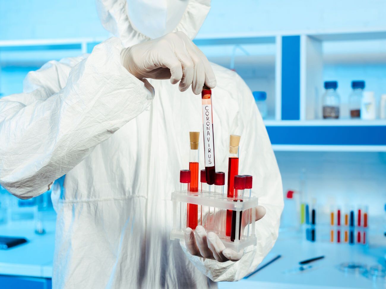 Коронавірусу в пацієнтки з Мукачева остаточно не підтверджено