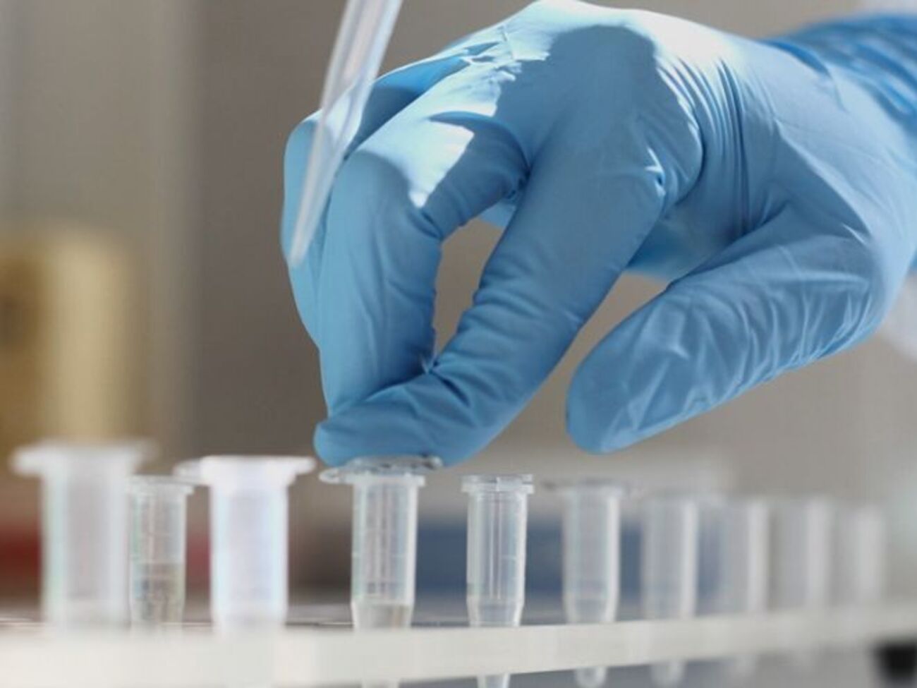 Чи був у чоловіка коронавірус, стане відомо 25 березня