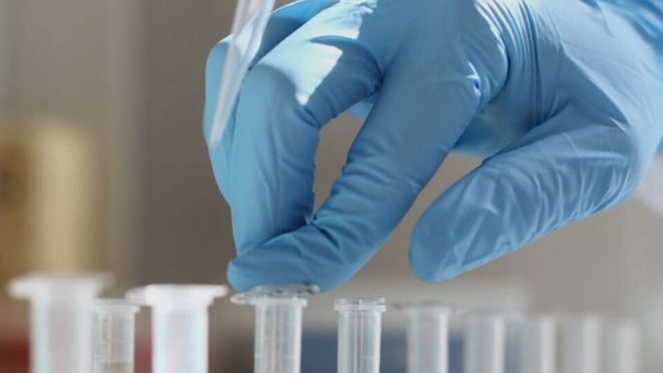 Чи був у чоловіка коронавірус, стане відомо 25 березня