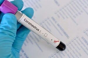 У женщины взяли дополнительные анализы на коронавирус и отправили их в Сумы