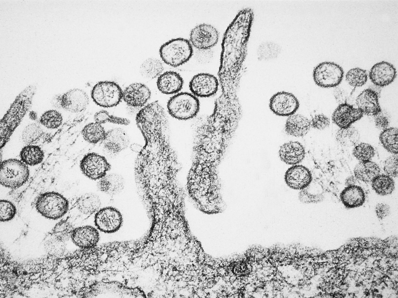 Зображення вірусу Sin Nombre із сімейства хантавірусів
