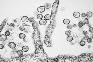 Зображення вірусу Sin Nombre із сімейства хантавірусів