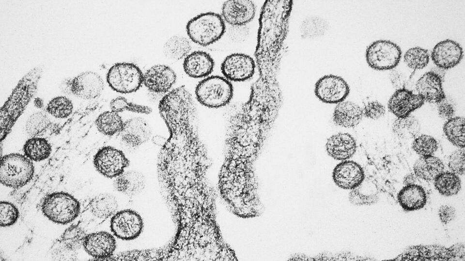 Изображение вируса Sin Nombre из семейства хантавирусов