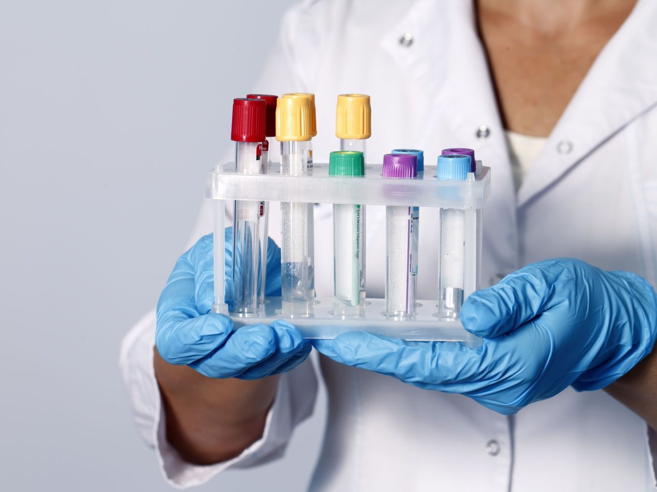 19 марта мэр Киева Виталий Кличко говорил, что у 50-летнего жителя столицы частная клиника обнаружила коронавирус, но не сообщила об этом в Минздрав