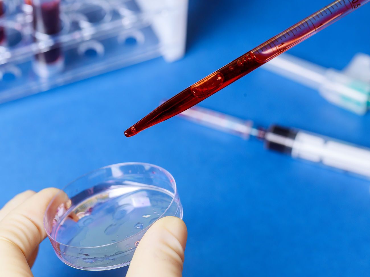 В Ровенской области подтверждено девять случаев инфицирования коронавирусом