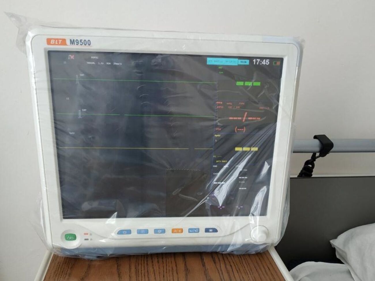 Київському перинатальному центру, який приймає вагітних і породіль із вірусними інфекціями, передали три реанімаційні монітори all-in-one