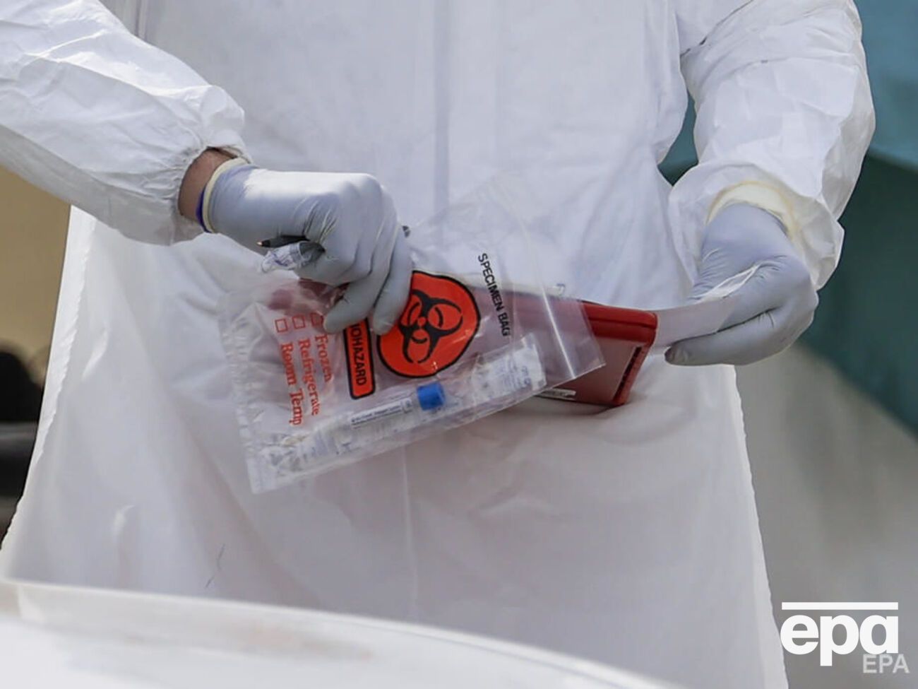 Всего в Украине из 1712 подозрений на COVID-19 подтвердили 418