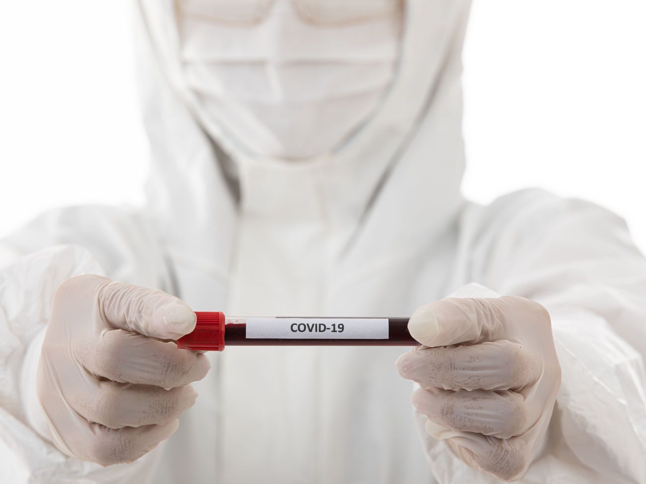 Случаи заражения коронавирусом зарегистрированы во всех регионах Украины, кроме Николаевской области