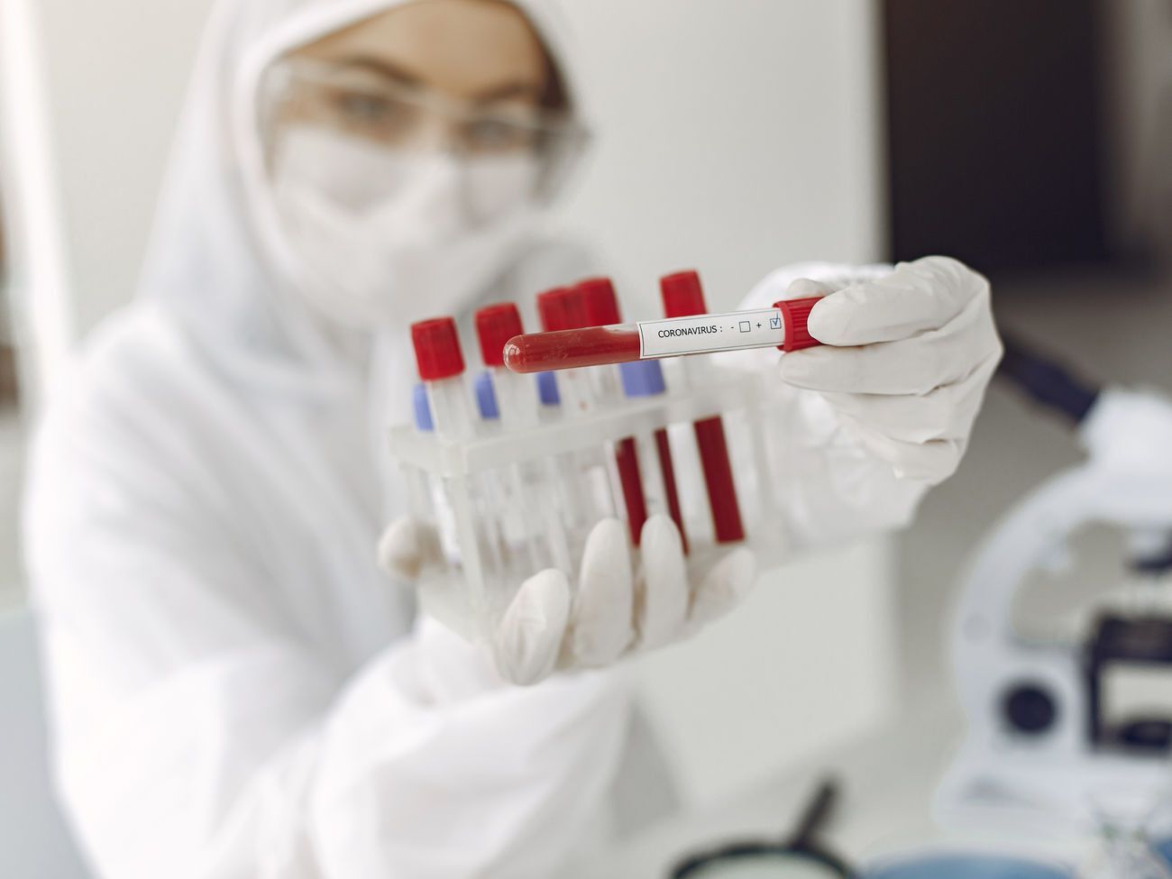 Від початку спалаху епідемії в Україні методом полімеразної ланцюгової реакції досліджено 35 153 проби на коронавірус