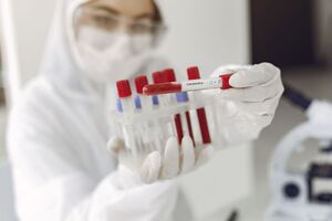 С начала вспышки эпидемии в Украине методом полимеразной цепной реакции исследовано 35 153 пробы на коронавирус