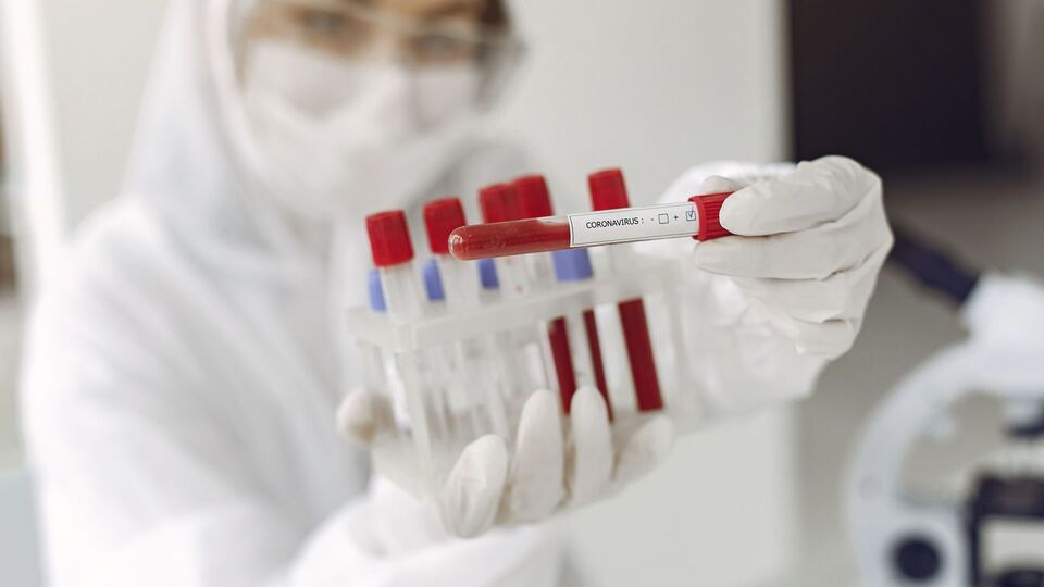 Від початку спалаху епідемії в Україні методом полімеразної ланцюгової реакції досліджено 35 153 проби на коронавірус