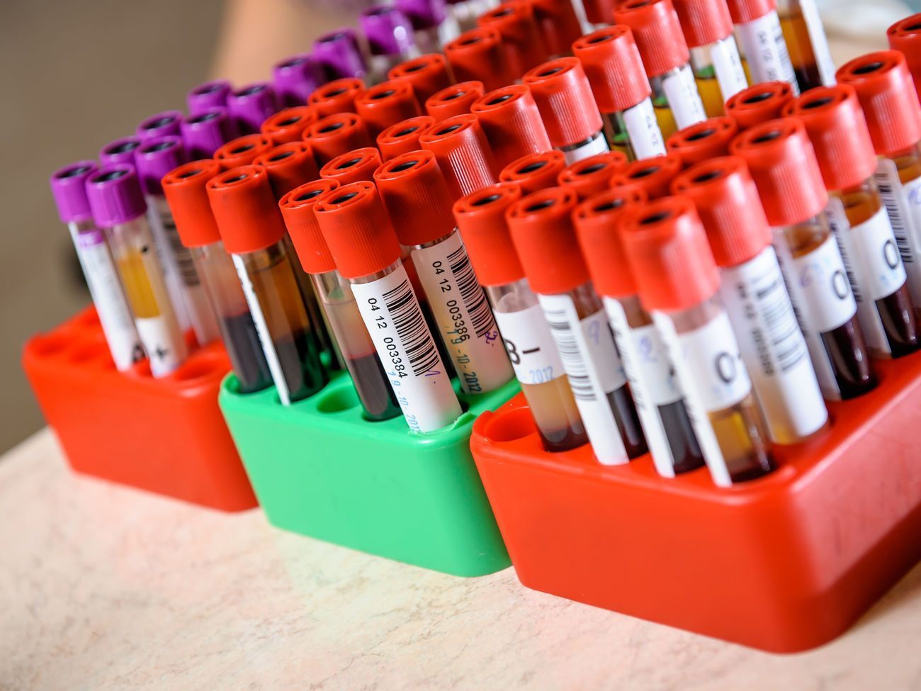 В Україні планують запустити тестування методом імуноферментного аналізу