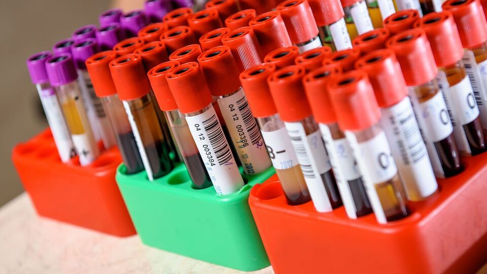 В Україні планують запустити тестування методом імуноферментного аналізу