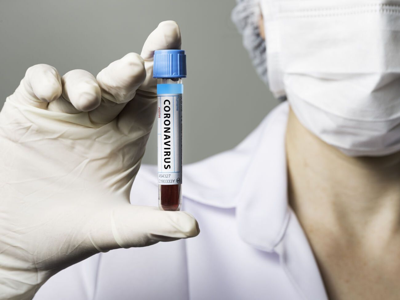 В Николаевской области коронавирус подтвержден у 14 человек