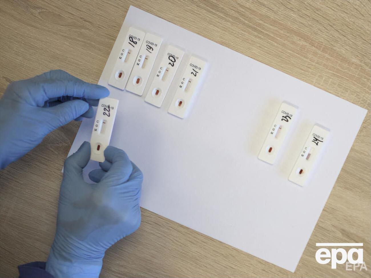 Тест на коронавирус у 84-летнего пациента в Кременчуге показал положительный результат