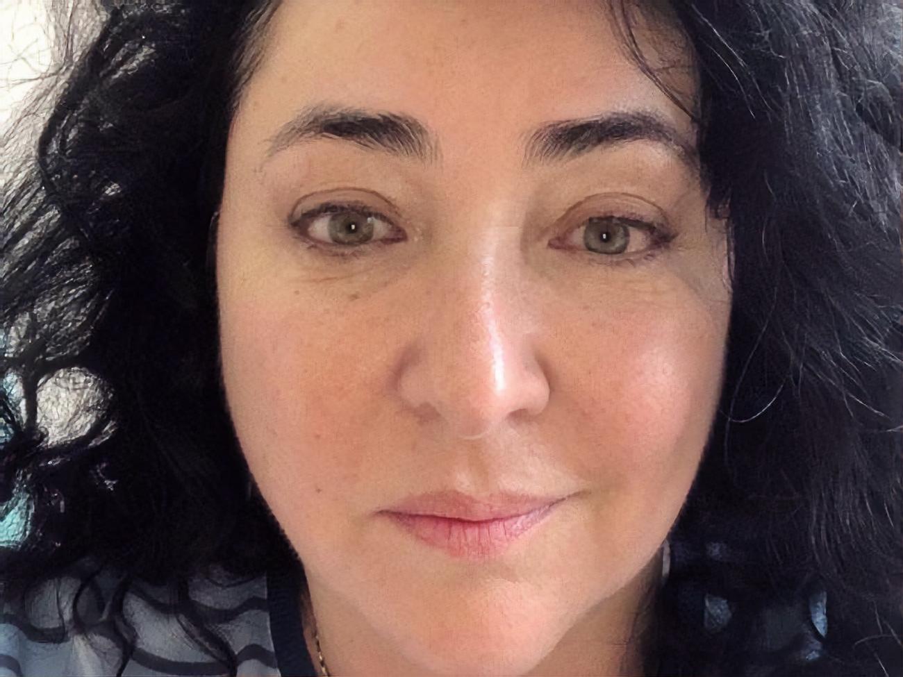 Лоліта про пластику грудей: Мені і свого багатства вистачає