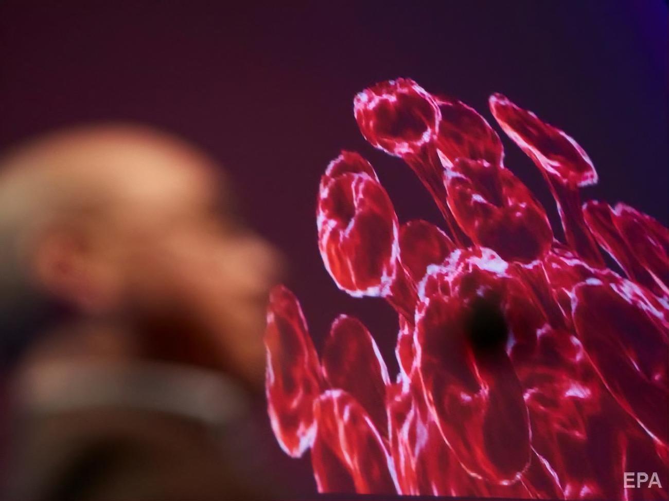 Эксперты обсуждают уроки и прогнозы пандемии COVID-19 для Украины. Трансляция