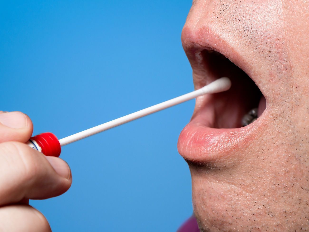 Многое зависит от правильности взятия мазка, говорят специалисты