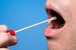 Багато залежить від правильності взяття мазка, кажуть фахівці