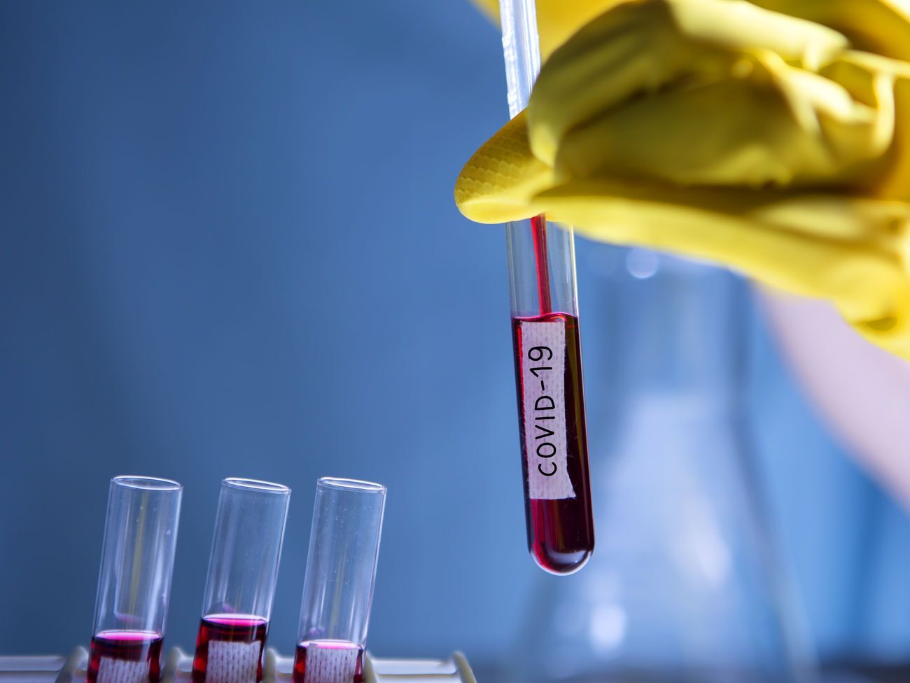 Країни, які зіткнулися з COVID-19 раніше, ніж Україна, мають ефективні напрацювання у боротьбі з цією хворобою, кажуть у МОЗ