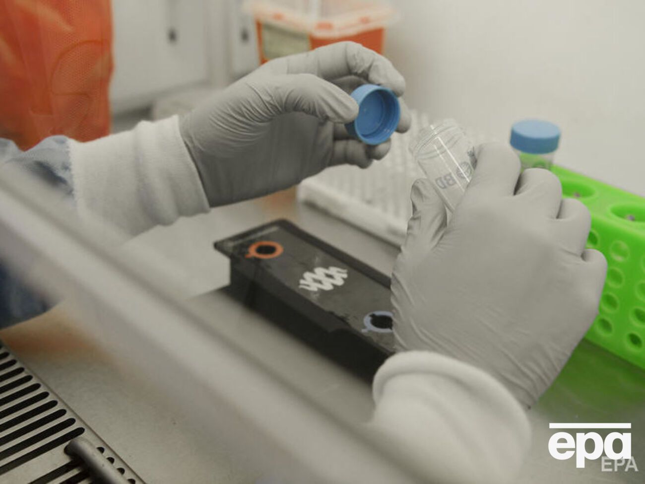 Для виявлення коронавірусу SARS-CoV-2 використовують тестування методом ПЛР (мазки беруть зі слизової носоглотки і ротоглотки). У випадку серологічного тестування аналізують сироватку крові