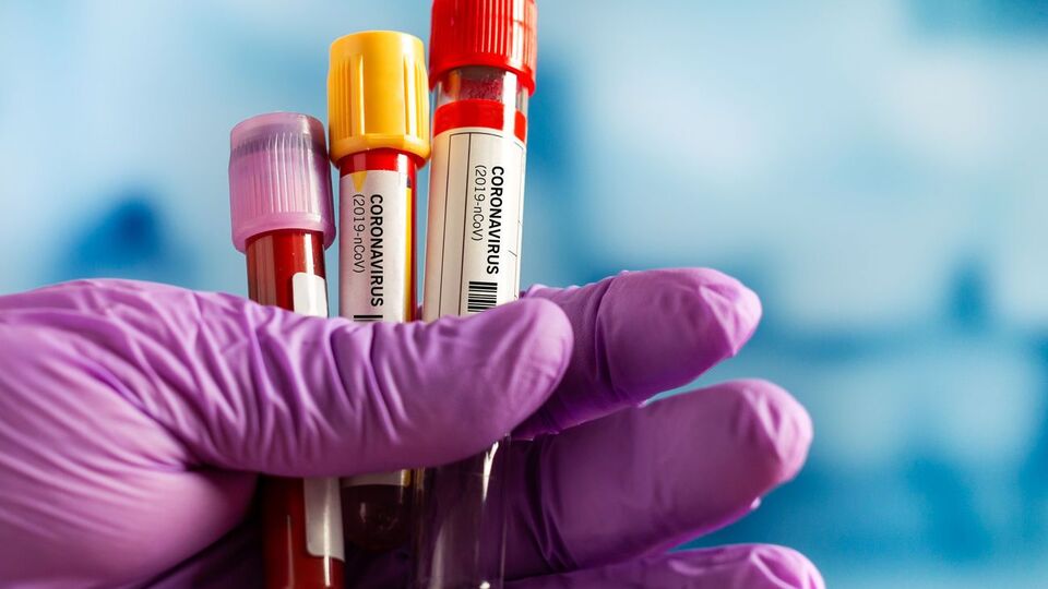 В Украине на утро 20 апреля выявлено 5710 заболевших COVID-19