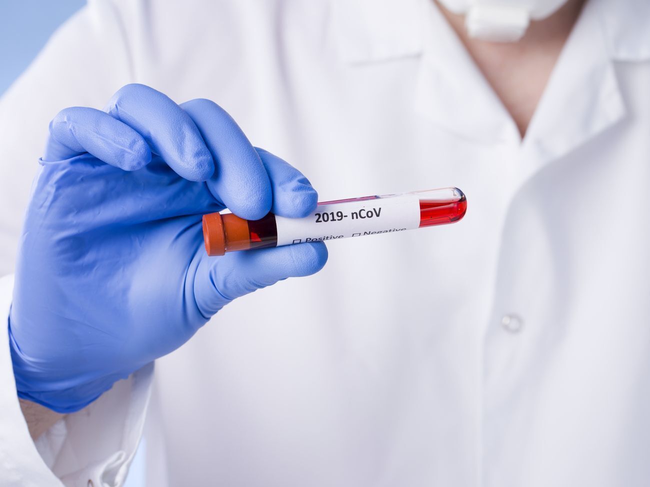 Кожен п'ятий інфікований коронавірусом в Україні &ndash; медичний працівник