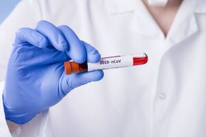 Кожен п'ятий інфікований коронавірусом в Україні – медичний працівник