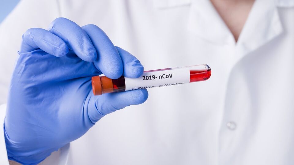 Кожен п'ятий інфікований коронавірусом в Україні – медичний працівник