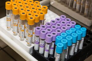 Усього в Тернополі зафіксовано 37 випадків COVID-19