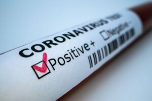 Лидируют по распространению заболевания Киев и Черновицкая область